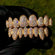 Introducing Our Dazzling Diamonds Grillz Collection VVS Clarity